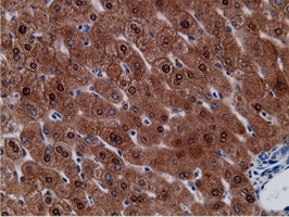CD80 Antibody - Immunohistochemical staining of paraffin-embedded Human liver tissue using anti-CD80 mouse monoclonal antibody.