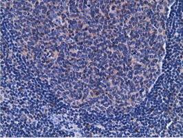 CD80 Antibody - Immunohistochemical staining of paraffin-embedded Human lymph node tissue using anti-CD80 mouse monoclonal antibody.