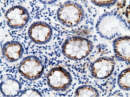 CD80 Antibody - IHC of paraffin-embedded Human colon tissue using anti-CD80 mouse monoclonal antibody.