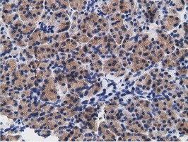 CD80 Antibody - IHC of paraffin-embedded Human pancreas tissue using anti-CD80 mouse monoclonal antibody.