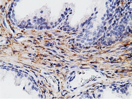 CD80 Antibody - IHC of paraffin-embedded Human prostate tissue using anti-CD80 mouse monoclonal antibody.