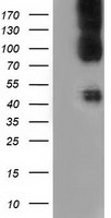 CD80 Antibody - HEK293T cells were transfected with the pCMV6-ENTRY control (Left lane) or pCMV6-ENTRY CD80 (Right lane) cDNA for 48 hrs and lysed. Equivalent amounts of cell lysates (5 ug per lane) were separated by SDS-PAGE and immunoblotted with anti-CD80.