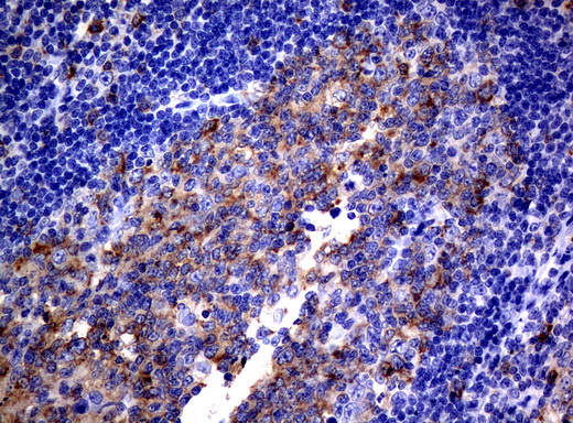 CD80 Antibody - Immunohistochemical staining of paraffin-embedded Human tonsil using anti-CD80 mouse monoclonal antibody.  heat-induced epitope retrieval by 10mM citric buffer, pH6.0, 120C for 3min)