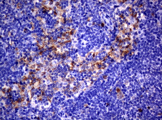 CD80 Antibody - Immunohistochemical staining of paraffin-embedded Human lymph node tissue using anti-CD80 mouse monoclonal antibody.  heat-induced epitope retrieval by 10mM citric buffer, pH6.0, 120C for 3min)