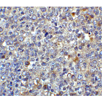CD80 Antibody - Immunohistochemistry of CD80 in human tonsil tissue with CD80 antibody at 2 µg/ml.