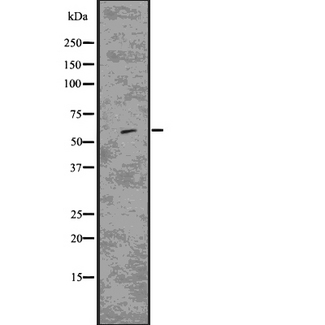 CD80 Antibody - Western blot analysis of CD80 using K562 whole lysates.