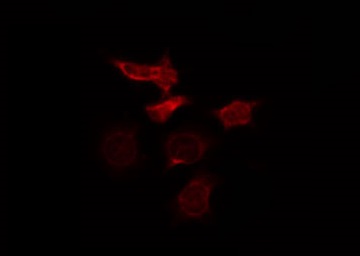 CD80 Antibody - Staining HepG2 cells by IF/ICC. The samples were fixed with PFA and permeabilized in 0.1% Triton X-100, then blocked in 10% serum for 45 min at 25°C. The primary antibody was diluted at 1:200 and incubated with the sample for 1 hour at 37°C. An Alexa Fluor 594 conjugated goat anti-rabbit IgG (H+L) Ab, diluted at 1/600, was used as the secondary antibody.