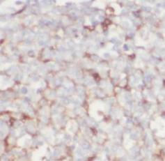 CD80 Antibody - Immunohistochemistry of paraffin-embedded human tonsillitis tissue slide using CD80 antibody at dilution of 1:200