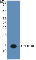 CD81 Antibody - Western Blot; Sample: Recombinant TAPA1, Human.