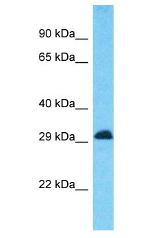 CD81 Antibody - CD81 antibody Western Blot of Placenta. Antibody dilution: 1 ug/ml.  This image was taken for the unconjugated form of this product. Other forms have not been tested.