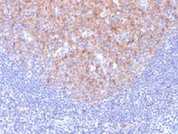 CD81 Antibody - IHC testing of FFPE human tonsil with CD81 antibody (clone 1.3.3.22). Required HIER: boil tissue sections in 10mM citrate buffer, pH 6, for 10-20 min followed by cooling at RT for 20 min.