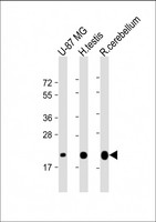 CD81 Antibody - All lanes: Anti-CD81 Antibody at 1:4000 dilution Lane 1: U-87 MG whole cell lysate Lane 2: human testis lysate Lane 3: rat cerebellum lysate Lysates/proteins at 20 µg per lane. Secondary Goat Anti-mouse IgG, (H+L), Peroxidase conjugated at 1/10000 dilution. Predicted band size: 26 kDa Blocking/Dilution buffer: 5% NFDM/TBST.
