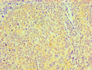 CD81 Antibody - Immunohistochemical of paraffin-embedded Human tonsil tissue using CD81 Monoclonal Antibody at dilution of 1:200.