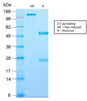 CD81 Antibody - SDS-PAGE Analysis Purified CD81 Rabbit Recombinant Monoclonal Antibody (C81/2885R). Confirmation of Purity and Integrity of Antibody.