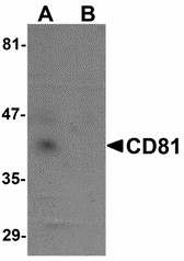 CD81 Antibody - Western blot of CD81 in human lung tissue lysate with CD81 antibody at 1 ug/ml in (A) the absence and (B) the presence of blocking peptide. Below: Immunohistochemistry of CD81 in human lung tissue with CD81 antibody at 5 ug/ml.