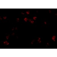 CD81 Antibody - Immunofluorescence of CD81 in A549 cells with CD81 antibody at 20 µg/mL.