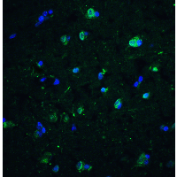 CD81 Antibody - Immunofluorescence of CD81 in human brain tissue with CD81 antibody at 10 µg/ml.