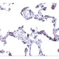 CD81 Antibody - Immunohistochemistry of CD81 in human lung tissue with CD81 antibody at 5 µg/mL.
