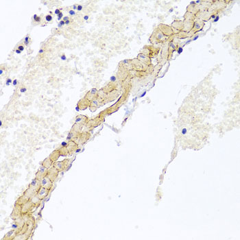 CD81 Antibody - Immunohistochemistry of paraffin-embedded mouse lung tissue.