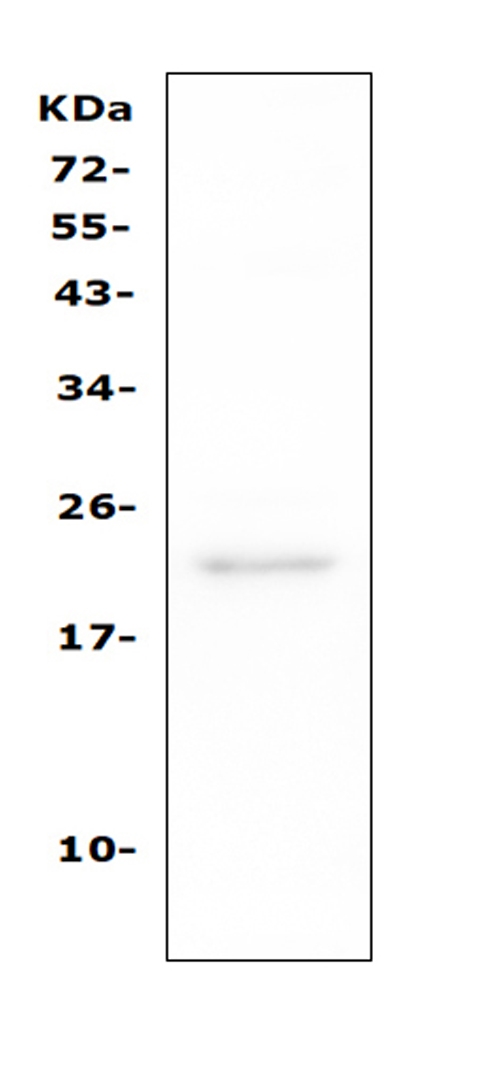 CD81 Antibody - Western blot analysis of TAPA1 using anti-TAPA1 antibody. Electrophoresis was performed on a 5-20% SDS-PAGE gel at 70V (Stacking gel) / 90V (Resolving gel) for 2-3 hours. The sample well of each lane was loaded with 50ug of sample under reducing conditions. Lane 1: mouse raw264. 7 whole cell lysates, After Electrophoresis, proteins were transferred to a Nitrocellulose membrane at 150mA for 50-90 minutes. Blocked the membrane with 5% Non-fat Milk/ TBS for 1.5 hour at RT. The membrane was incubated with rabbit anti-TAPA1 antigen affinity purified polyclonal antibody at 0.5 µg/mL overnight at 4°C, then washed with TBS-0.1% Tween 3 times with 5 minutes each and probed with a goat anti-rabbit IgG-HRP secondary antibody at a dilution of 1:10000 for 1.5 hour at RT. The signal is developed using an Enhanced Chemiluminescent detection (ECL) kit with Tanon 5200 system. A specific band was detected for TAPA1 at approximately 22KD. The expected band size for TAPA1 is at 22KD.