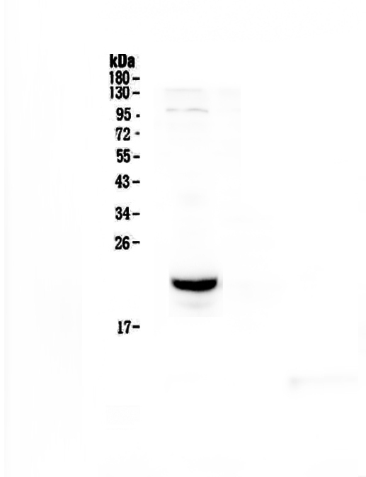 CD81 Antibody - Western blot - Anti-TAPA1 Picoband antibody