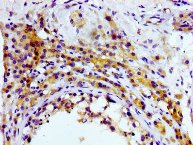 CD81 Antibody - Immunohistochemistry Dilution at 1:100 and staining in paraffin-embedded human testis tissue performed on a Leica BondTM system. After dewaxing and hydration, antigen retrieval was mediated by high pressure in a citrate buffer (pH 6.0). Section was blocked with 10% normal Goat serum 30min at RT. Then primary antibody (1% BSA) was incubated at 4°C overnight. The primary is detected by a biotinylated Secondary antibody and visualized using an HRP conjugated SP system.