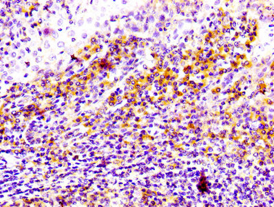 CD81 Antibody - Immunohistochemistry Dilution at 1:100 and staining in paraffin-embedded human tonsil tissue performed on a Leica BondTM system. After dewaxing and hydration, antigen retrieval was mediated by high pressure in a citrate buffer (pH 6.0). Section was blocked with 10% normal Goat serum 30min at RT. Then primary antibody (1% BSA) was incubated at 4°C overnight. The primary is detected by a biotinylated Secondary antibody and visualized using an HRP conjugated SP system.