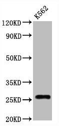 CD81 Antibody - Western Blot Positive WB detected in:K562 whole cell lysate All Lanes:CD81 antibody at 1.25µg/ml Secondary Goat polyclonal to rabbit IgG at 1/50000 dilution Predicted band size: 26 KDa Observed band size: 26 KDa