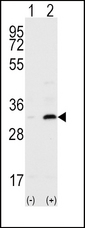 CD82 Antibody - Western blot of ST6 (arrow) using ST6 Antibody. 293 cell lysates (2 ug/lane) either nontransfected (Lane 1) or transiently transfected with the CD82 gene (Lane 2) (Origene Technologies).
