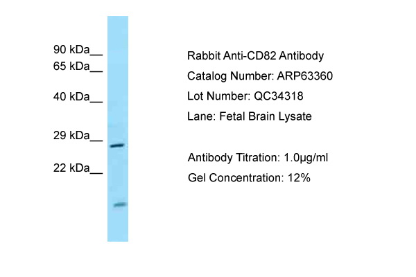 CD82 Antibody -  This image was taken for the unconjugated form of this product. Other forms have not been tested.