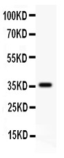 CD82 Antibody - CD82 antibody Western blot. All lanes: Anti CD82 at 0.5 ug/ml. WB: Recombinant Human CD82 Protein 0.5ng. Predicted band size: 36 kD. Observed band size: 36 kD.