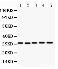 CD82 Antibody - CD82 antibody Western blot. All lanes: Anti CD82 at 0.5 ug/ml. Lane 1: HL-60 Whole Cell Lysate at 40 ug. Lane 2: CEM Whole Cell Lysate at 40 ug. Lane 3: HUT Whole Cell Lysate at 40 ug. Lane 4: U937 Whole Cell Lysate at 40 ug. Lane 5: MCF-7 Whole Cell Lysate at 40 ug. Predicted band size: 30 kD. Observed band size: 30 kD.