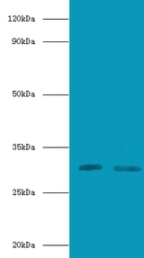 CD82 Antibody - Western blot of CD82 antigen antibody at 2 ug/ml lane 1: Jurkat whole cell lysate lane 2: A549 whole cell lysate secondary Goat polyclonal to rabbit at 1:10000 dilution predicted band size: 30 KDa observed band size: 30 KDa.  This image was taken for the unconjugated form of this product. Other forms have not been tested.