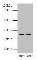 CD82 Antibody - Western blot All lanes: CD82 antigen antibody at 2µg/ml Lane 1: jurkat whole cell lysate Lane 2: A549 whole cell lysate Secondary Goat polyclonal to rabbit IgG at 1/10000 dilution Predicted band size: 30 kDa Observed band size: 30 kDa