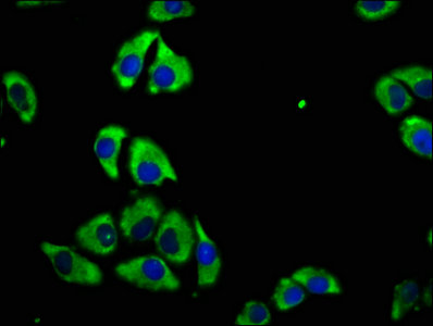 CD82 Antibody - Immunofluorescence staining of A549 cells with CD82 Antibody at 1:100, counter-stained with DAPI. The cells were fixed in 4% formaldehyde, permeabilized using 0.2% Triton X-100 and blocked in 10% normal Goat Serum. The cells were then incubated with the antibody overnight at 4°C. The secondary antibody was Alexa Fluor 488-congugated AffiniPure Goat Anti-Rabbit IgG(H+L).