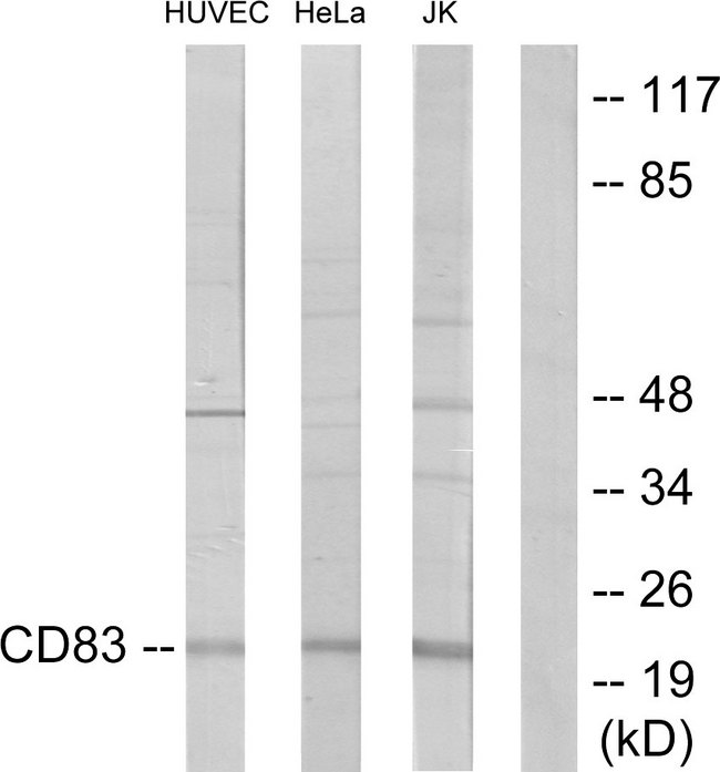 CD83 Antibody - Western blot analysis of lysates from HepG2 cells, HUVEC cells, HeLa cells, and Jurkat cells, using CD83 Antibody. The lane on the right is blocked with the synthesized peptide.