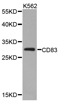 CD83 Antibody - Western blot analysis of extracts of K562 cell lines, using CD83 antibody.