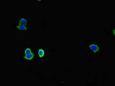 CD83 Antibody - Immunofluorescent analysis of HepG2 cells diluted at 1:100 and Alexa Fluor 488-congugated AffiniPure Goat Anti-Rabbit IgG(H+L)