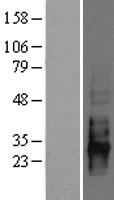 CD83 Protein - Western validation with an anti-DDK antibody * L: Control HEK293 lysate R: Over-expression lysate