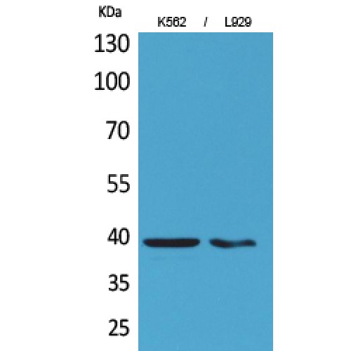 CD84 / SLAMF5 Antibody - Western blot of CD84 antibody