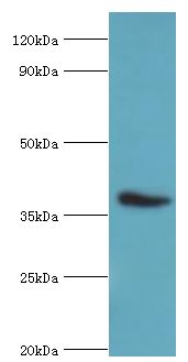 CD84 / SLAMF5 Antibody - Western blot. All lanes: SLAM family member 5 antibody at 6 ug/ml+mouse liver tissue. Secondary antibody: Goat polyclonal to rabbit at 1:10000 dilution. Predicted band size: 39 kDa. Observed band size: 39 kDa Immunohistochemistry.
