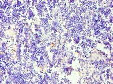 CD84 / SLAMF5 Antibody - Immunohistochemistry of paraffin-embedded human thymus using antibody at 1:100 dilution.
