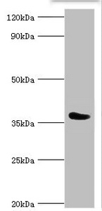 CD84 / SLAMF5 Antibody - Western blot All lanes: SLAM family member 5 antibody at 6µg/ml + Mouse liver tissue Secondary Goat polyclonal to rabbit IgG at 1/10000 dilution Predicted band size: 39, 37, 32, 31, 27, 25 kDa Observed band size: 39 kDa