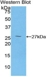 CD84 / SLAMF5 Antibody - Western blot of recombinant CD84.  This image was taken for the unconjugated form of this product. Other forms have not been tested.
