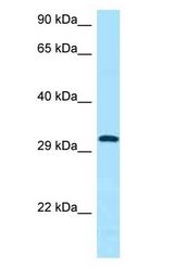 CD84 / SLAMF5 Antibody - CD84 antibody Western Blot of Fetal Kidney.  This image was taken for the unconjugated form of this product. Other forms have not been tested.
