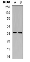 CD84 / SLAMF5 Antibody - Western blot analysis of CD84 expression in MDAMB231 (A); Raji (B) whole cell lysates.