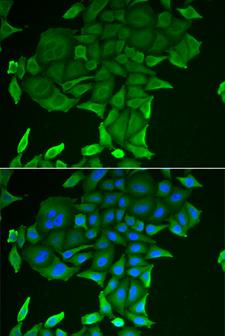 CD84 / SLAMF5 Antibody - Immunofluorescence analysis of HeLa cells.