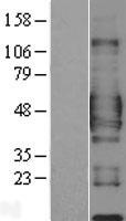 CD84 / SLAMF5 Protein - Western validation with an anti-DDK antibody * L: Control HEK293 lysate R: Over-expression lysate