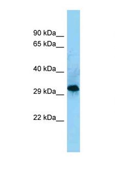 CD86 Antibody - CD86 antibody Western blot of COL0205 Cell lysate. Antibody concentration 1 ug/ml.  This image was taken for the unconjugated form of this product. Other forms have not been tested.