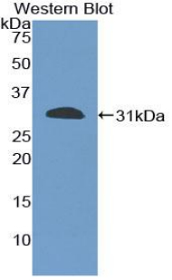 CD86 Antibody - Western blot of recombinant CD86.  This image was taken for the unconjugated form of this product. Other forms have not been tested.